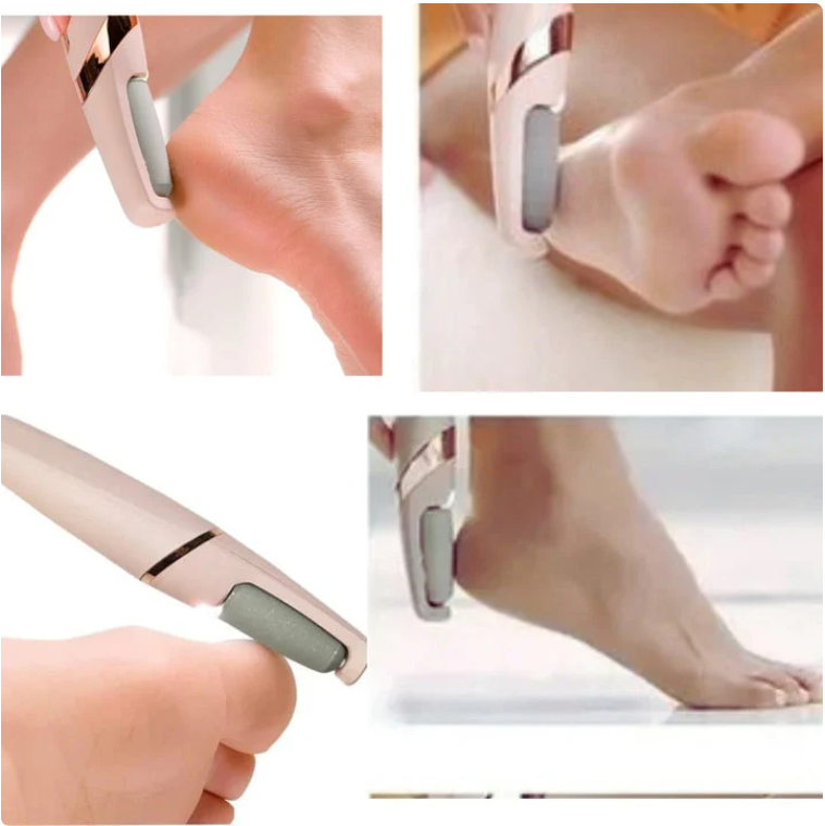 Eliminador de Callos Eléctrico Recargable - SOFTFEET PRO™