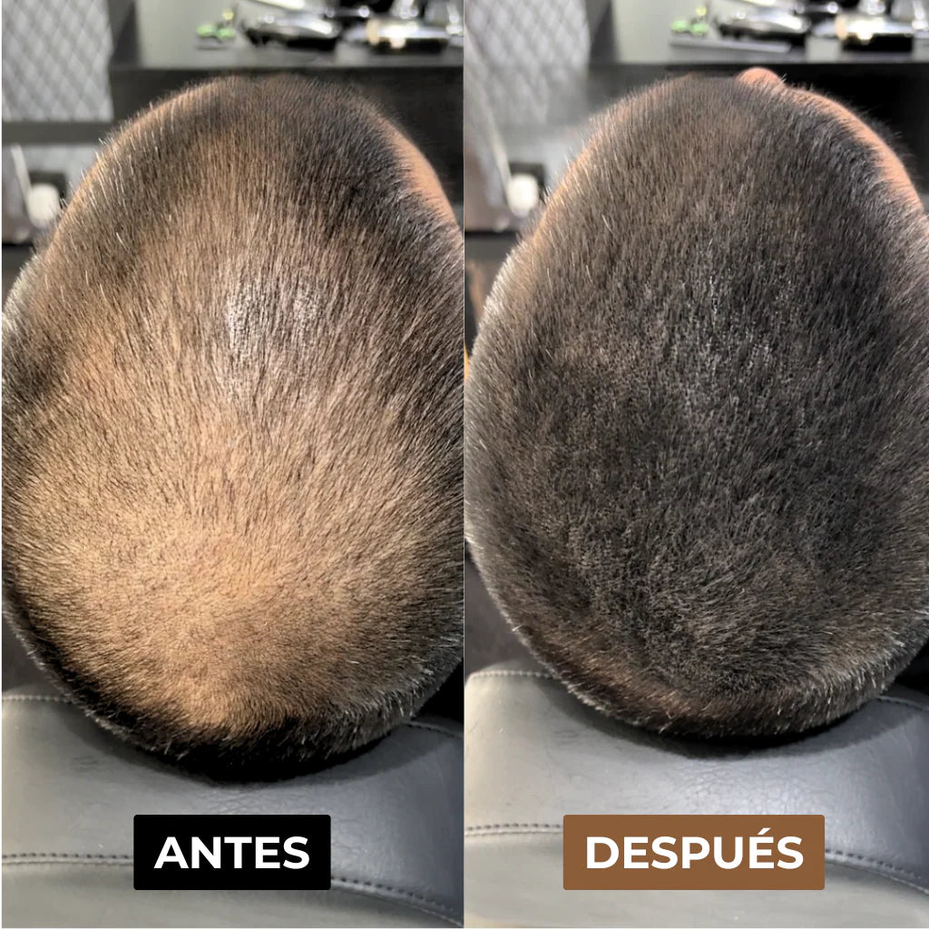 Camuflaje Capilar DX™