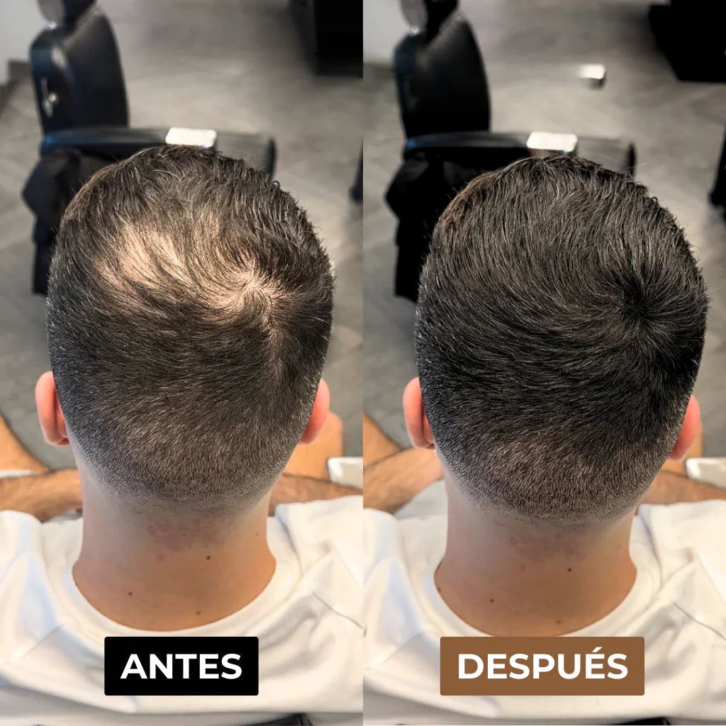 Camuflaje Capilar DX™