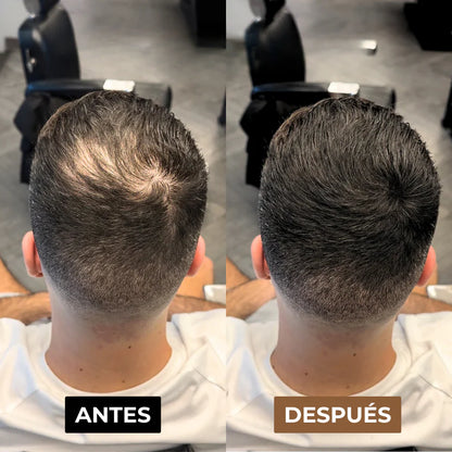 Camuflaje Capilar DX™